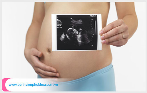 Địa chỉ siêu âm thai 18 tuần tuổi bạn nên đến?