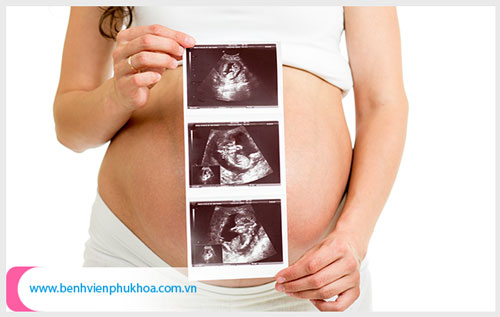 Nên siêu âm thai 32 tuần ở đâu tại Tphcm?
